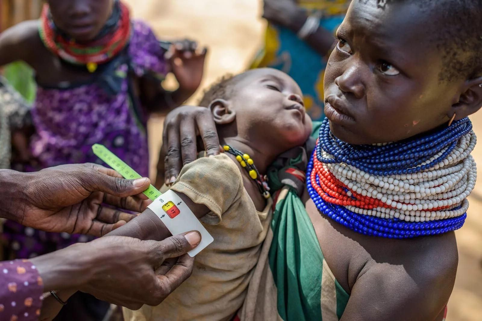 Цифри щороку ростуть: у світі голодують понад 800 мільйонів людей Цифри щороку ростуть: у світі голодують понад 800 мільйонів людей