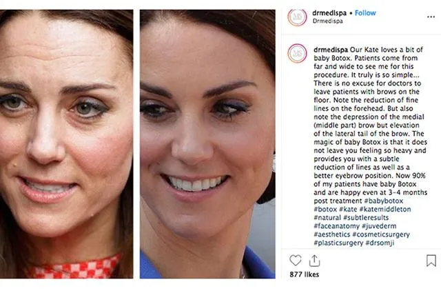 Кейт Міддлтон потрапила до гучного скандалу Кейт Міддлтон потрапила до гучного скандалу