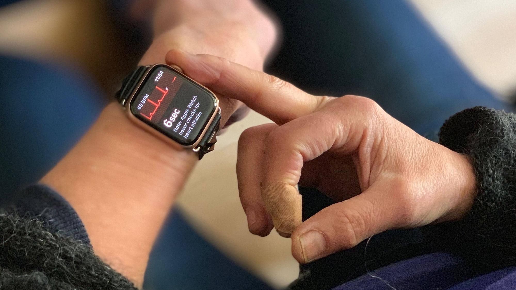 Не такие уж и полезные: врачи-кардиологи раскритиковали смарт-часы Apple Watch 4