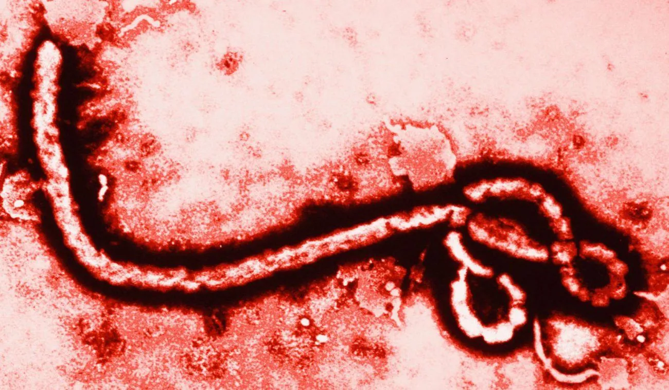 Вірус Ебола під мікроскопом 