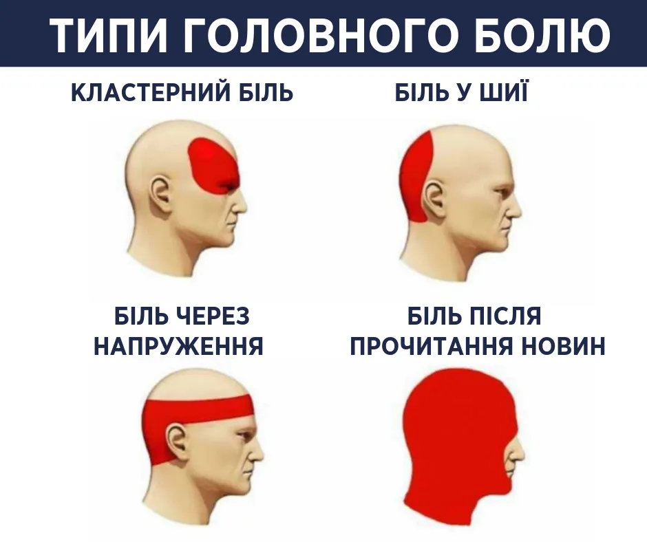 Типи головного болю