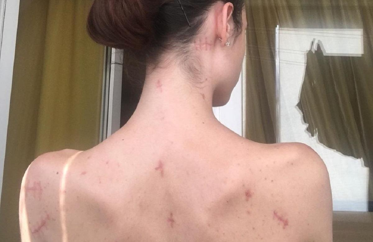 19 ножевых ранений: под Одессой парень чуть не убил бывшую возлюбленную: фото 18+