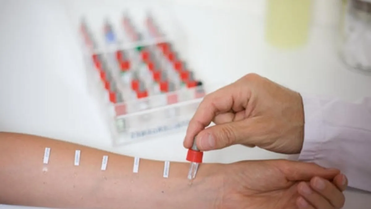 Перевірятись на алергени потрібно під наглядом алерголога Перевірятись на алергени потрібно під наглядом алерголога