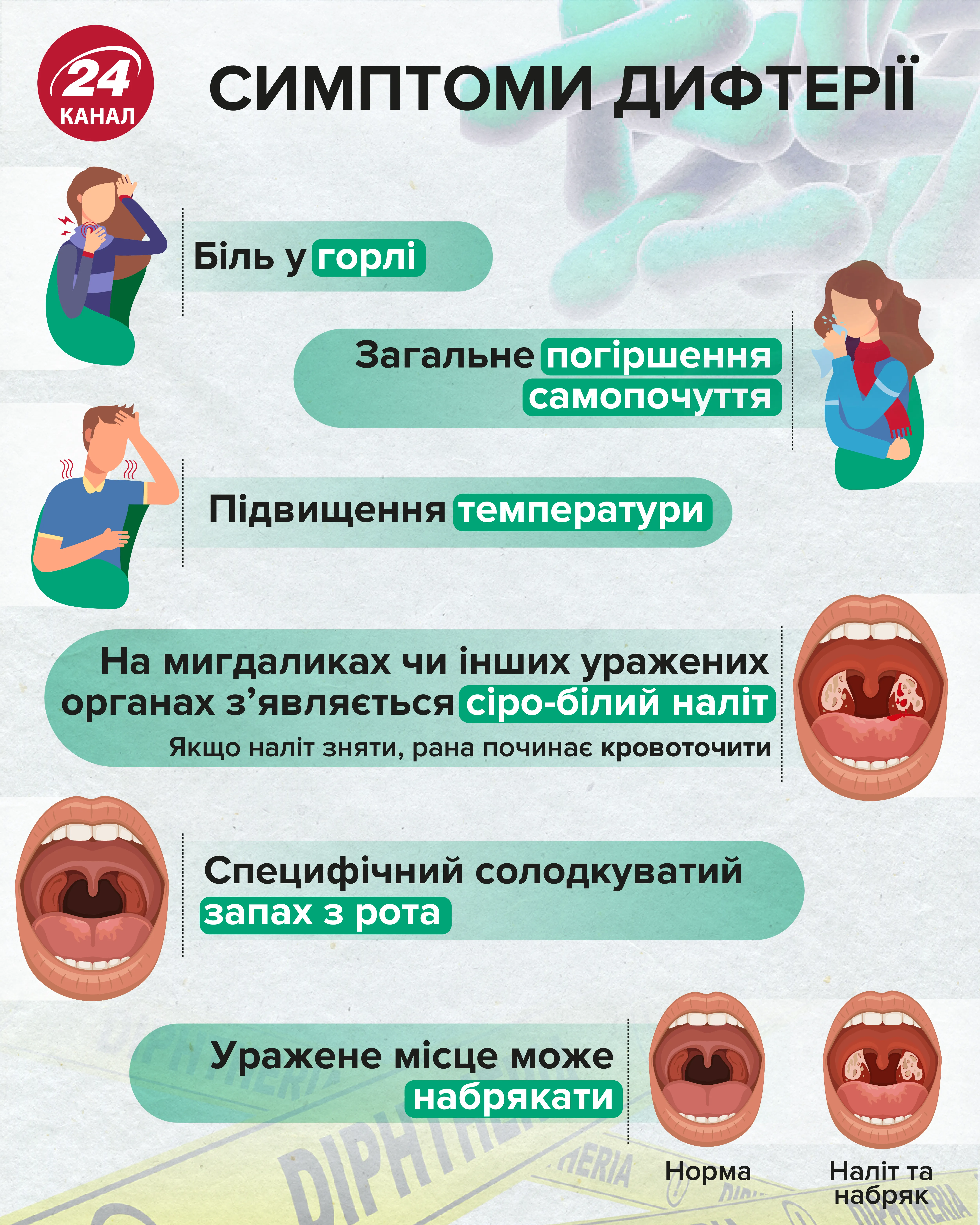 симптоми дифтерії Україна