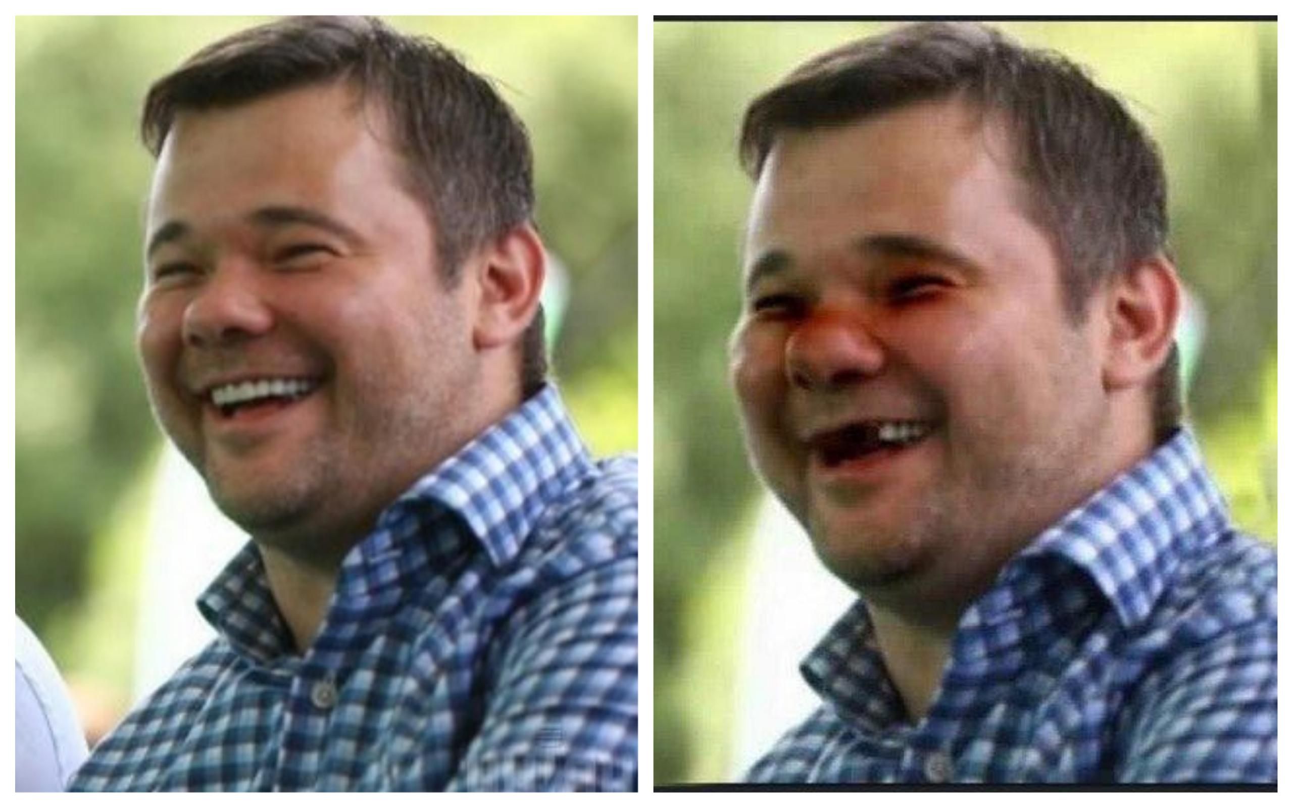 Богдан опубликовал фото с выбитыми зубами и синяками: бурная реакция сети
