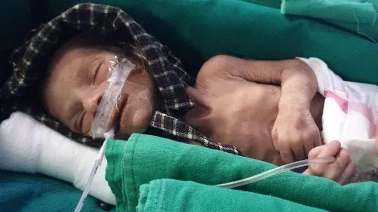 Недоношена дівчинка закопали живцем Індія