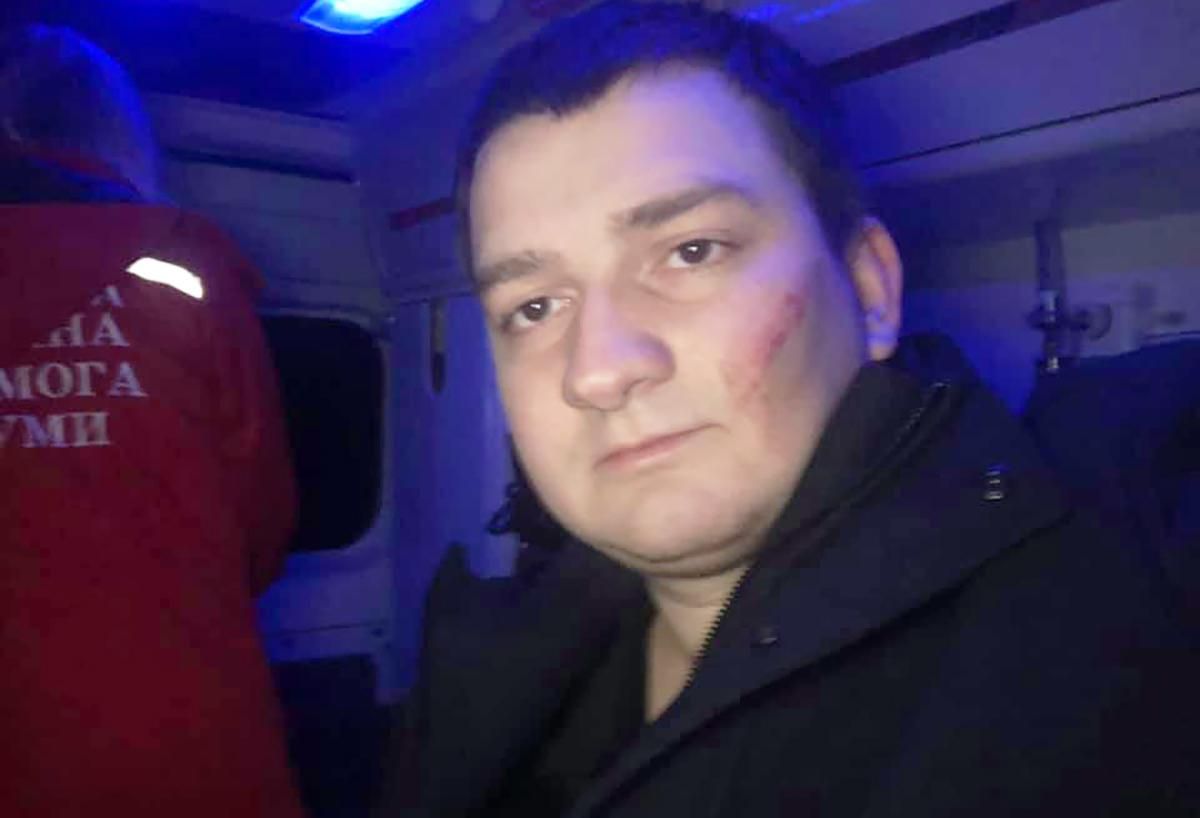 Побиття нардепа від "Слуги народу" Ананченка інсценували: хто і навіщо Побиття нардепа від "Слуги народу" Ананченка інсценували: хто і навіщо