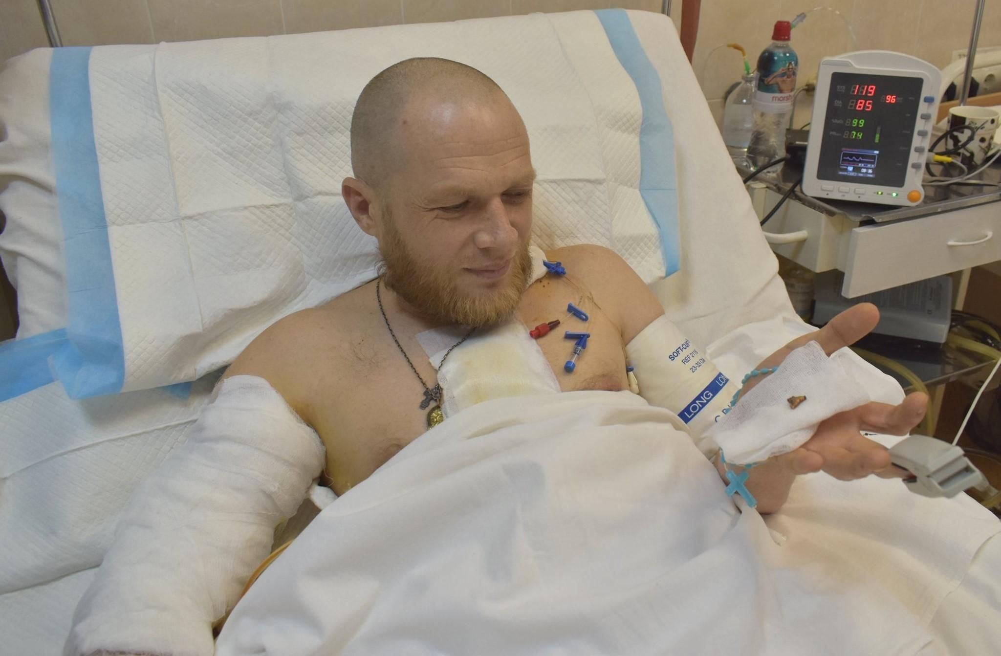 Шансов почти не было, – в Днепре врачи спасли раненого снайпером бойца Шансов почти не было, – в Днепре врачи спасли раненого снайпером бойца