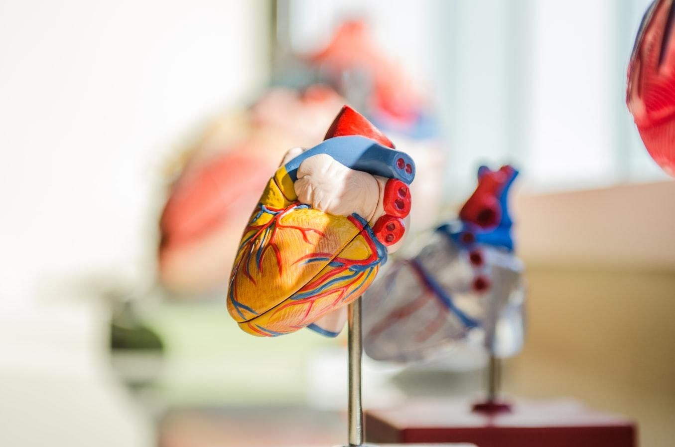 Сервис Cardio Visionдля борьбы с болезнями сердца