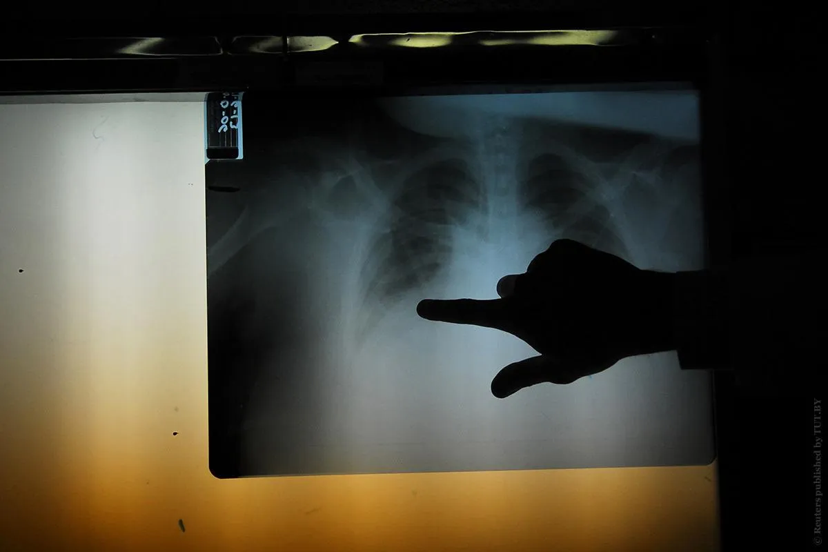 Деякі ракові пухлини не потребують лікування Деякі ракові пухлини не потребують лікування