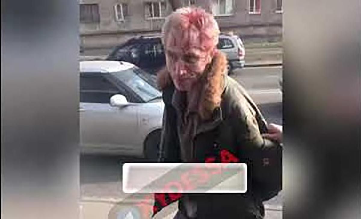 В Одессе неизвестный устроил стрельбу на остановке: есть пострадавший – видео