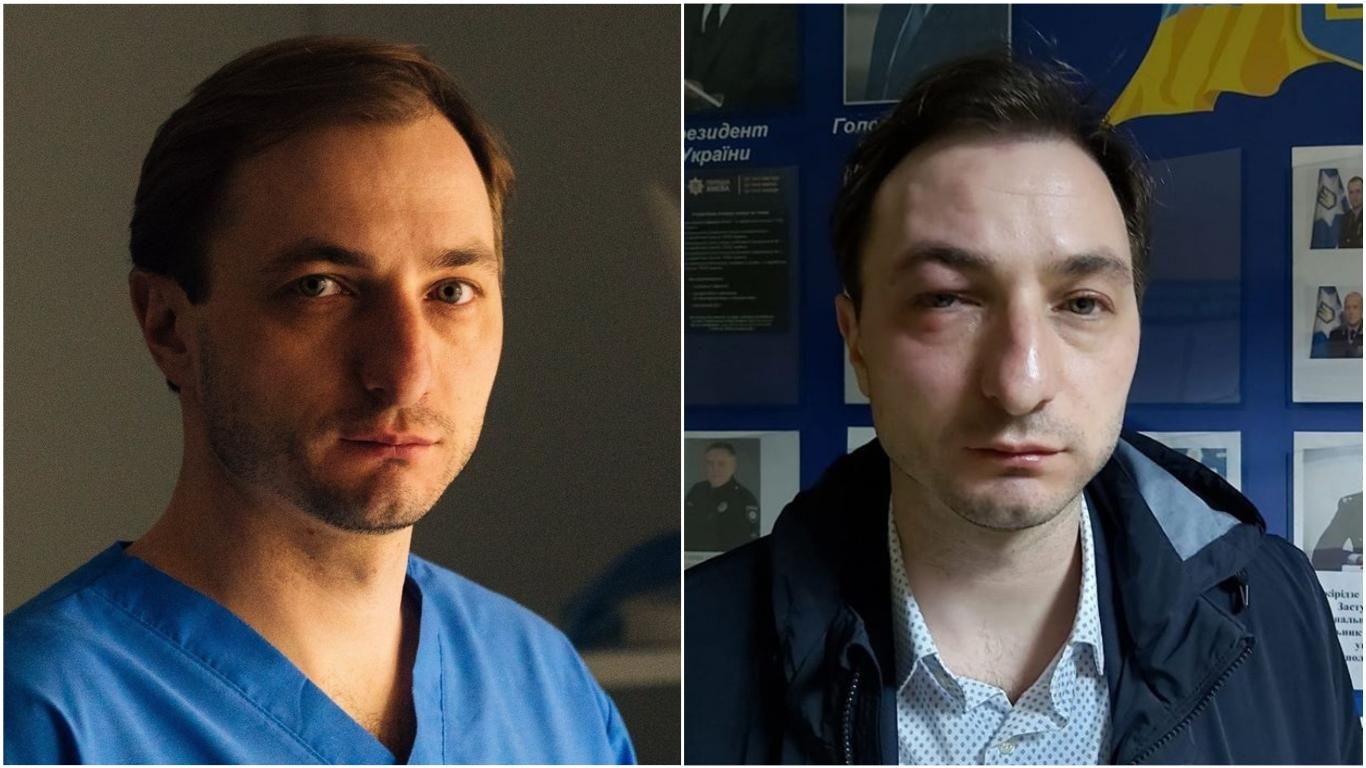 В Киеве жестоко избили главного врача Института рака Безносенко: фото, видео