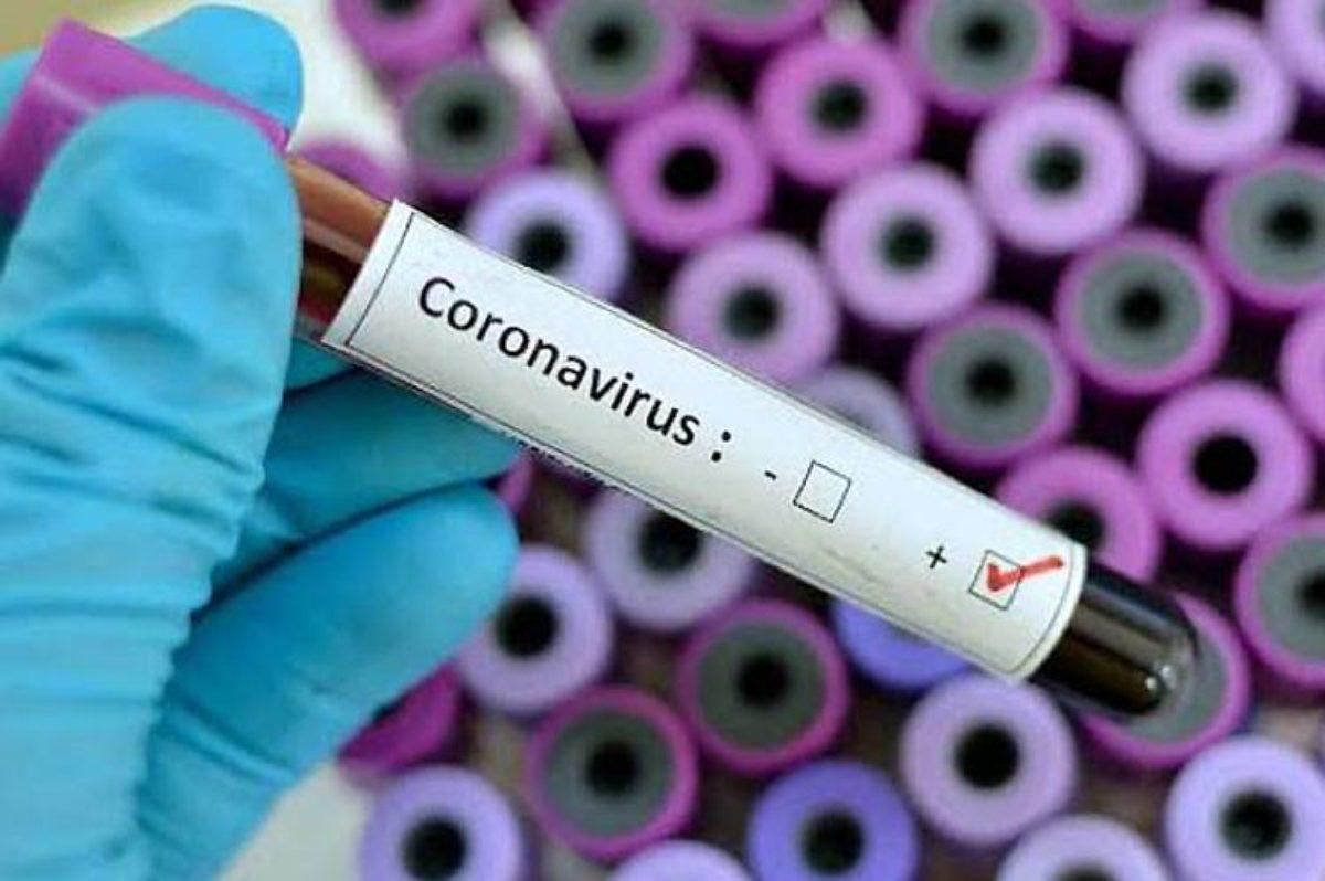 Вірус не стає менш агресивним, – науковець про мутації коронавірусу