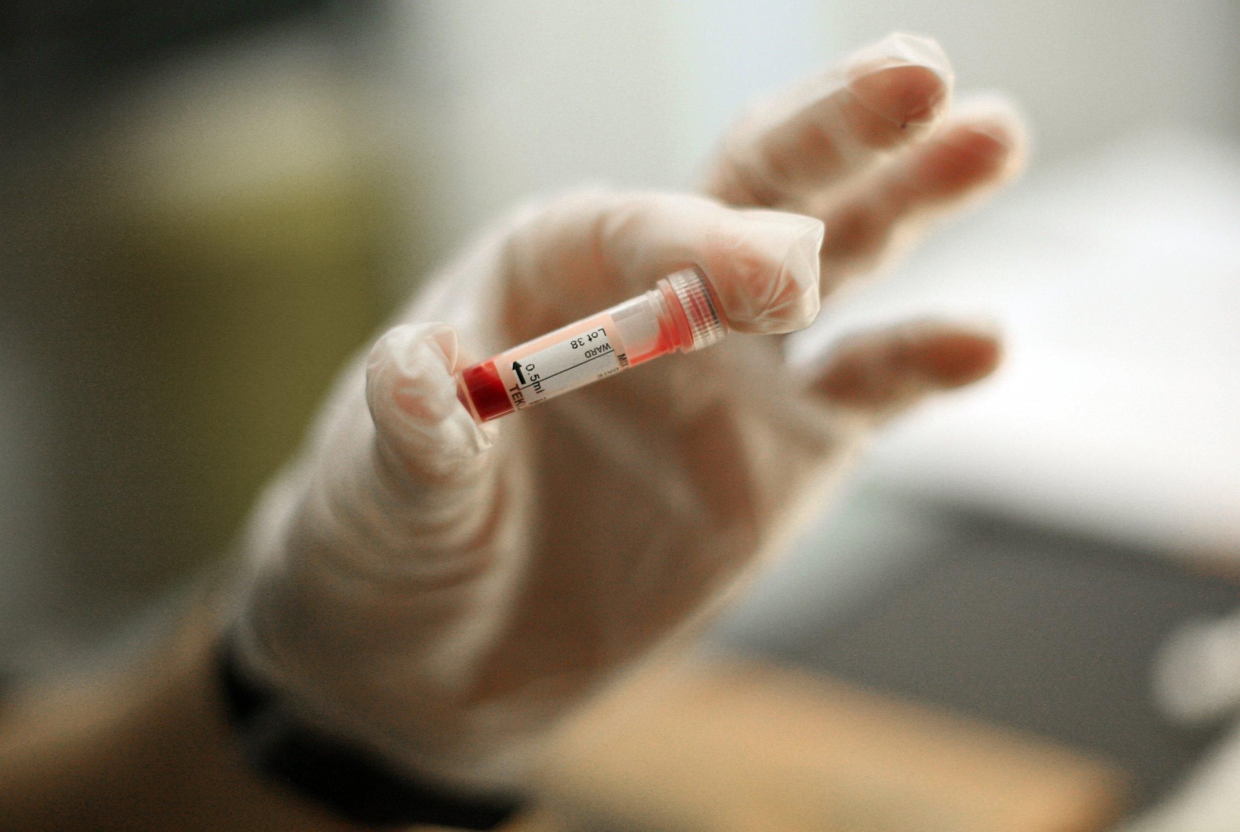 Приватна клініка приховала виявлений коронавірус у киянина: прокуратура відкрила справу