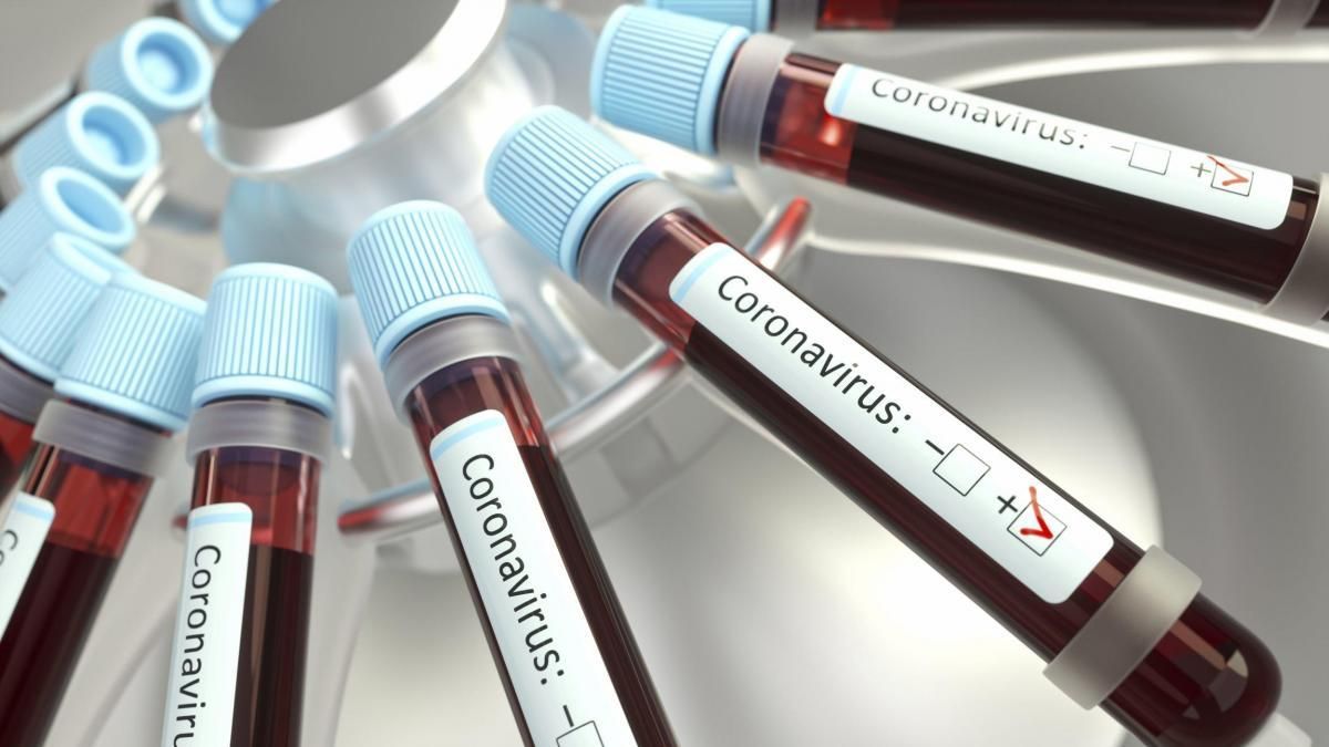 У Києві виявили нові 4 випадки зараження коронавірусом: тепер у столиці 28 інфікованих