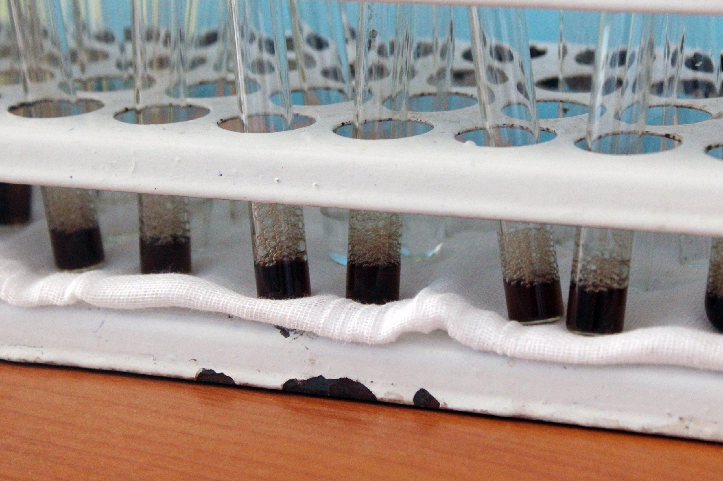 У Кривому Розі виявили перший випадок коронавірусу У Кривому Розі виявили перший випадок коронавірусу