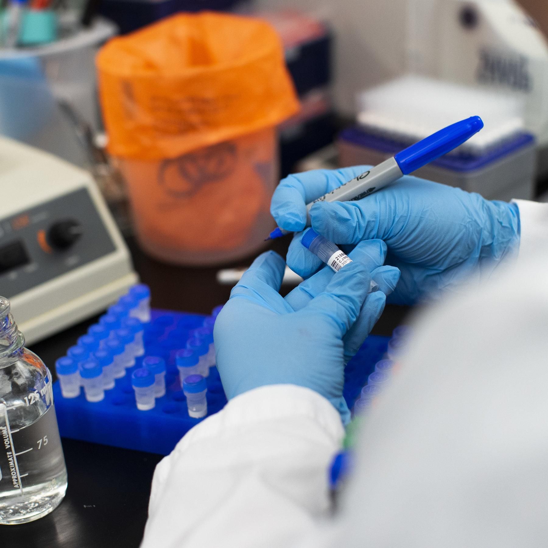 Гастарбайтер с подозрением на коронавирус сбежала из киевской больницы, – СМИ Гастарбайтер с подозрением на коронавирус сбежала из киевской больницы, – СМИ