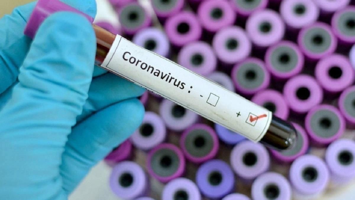 МХП перечислил 55 миллионов в общенациональный фонд противодействия коронавирусу