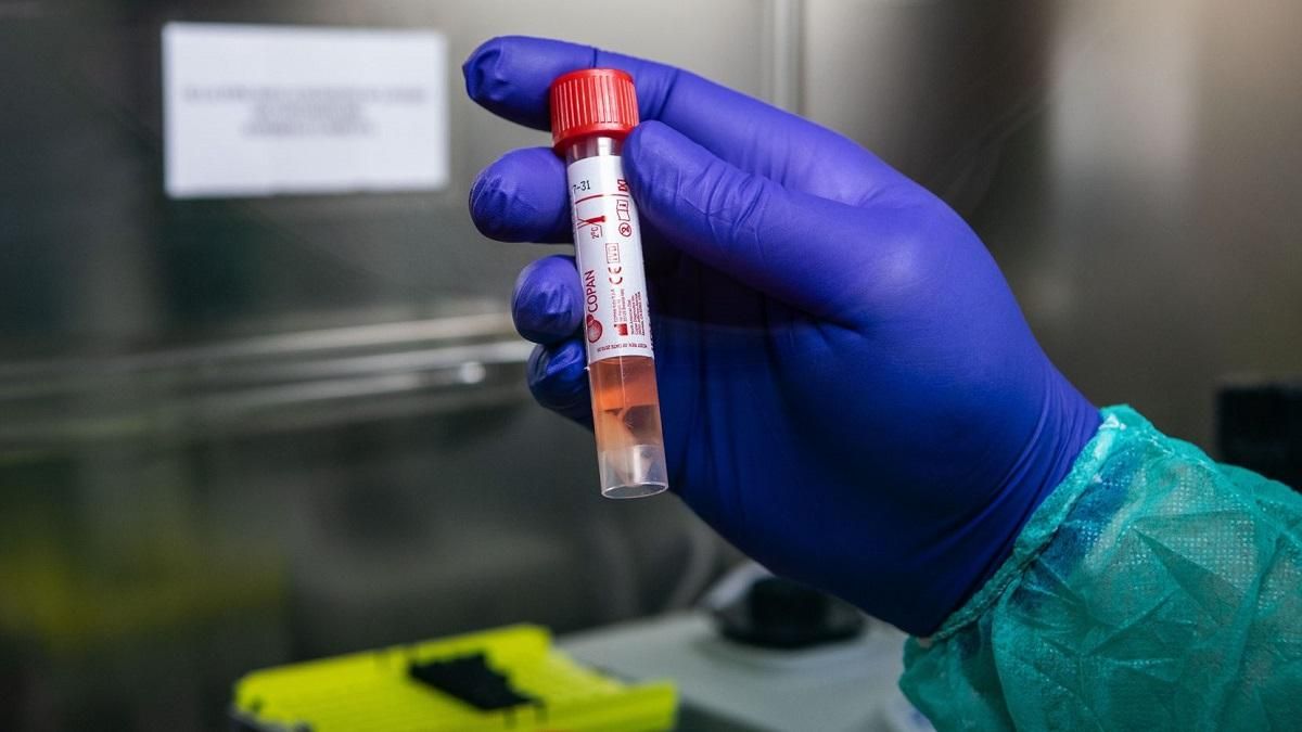Ще два випадки коронавірусу зафіксували в Ірпені