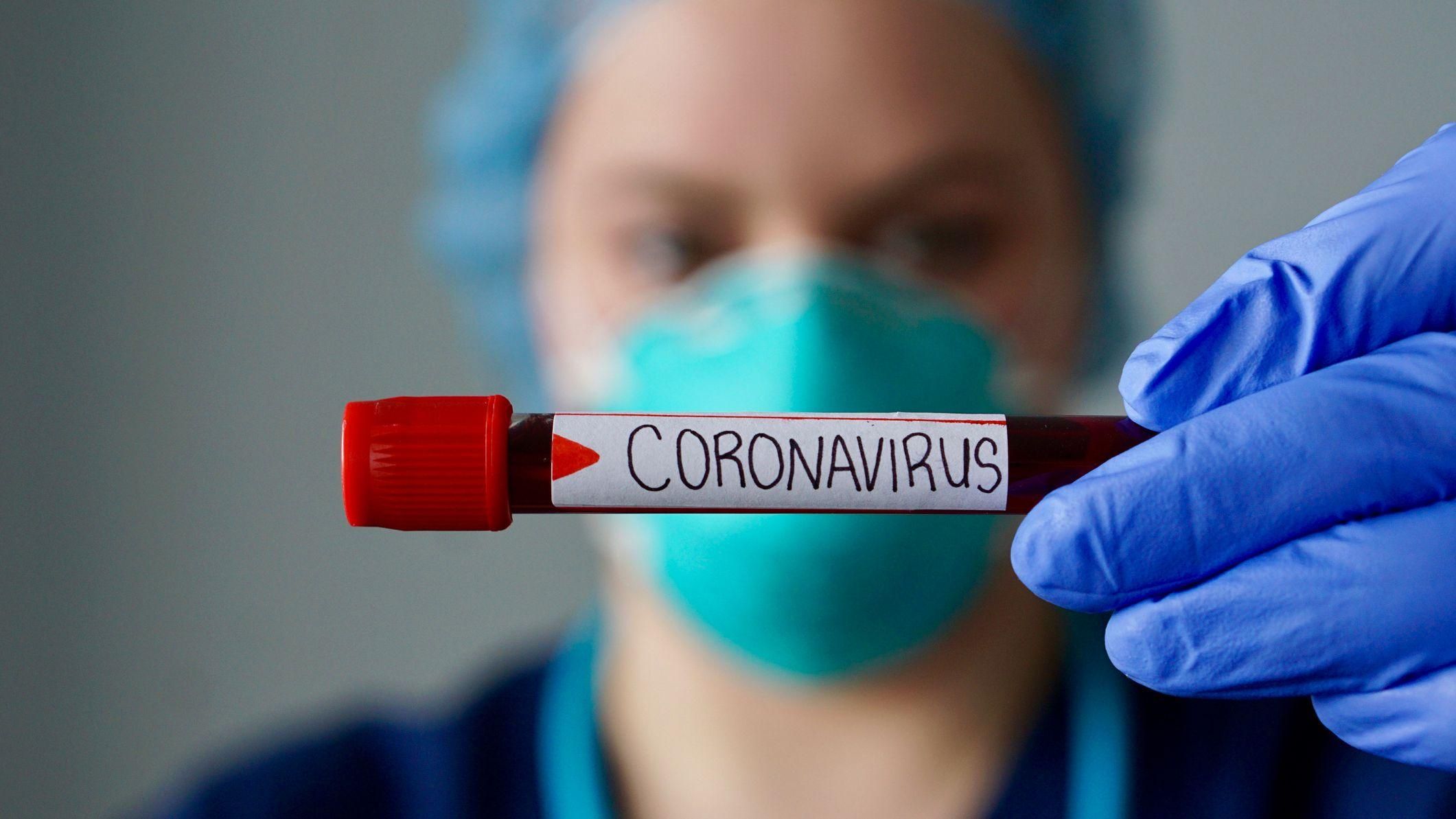 У Росії коронавірус підозрюють у 180 тисяч людей