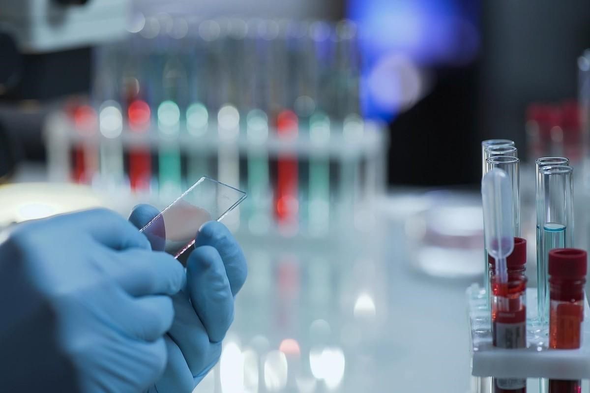 Штучний інтелект навчили визначати чи викличе коронавірус ускладнення Штучний інтелект навчили визначати чи викличе коронавірус ускладнення