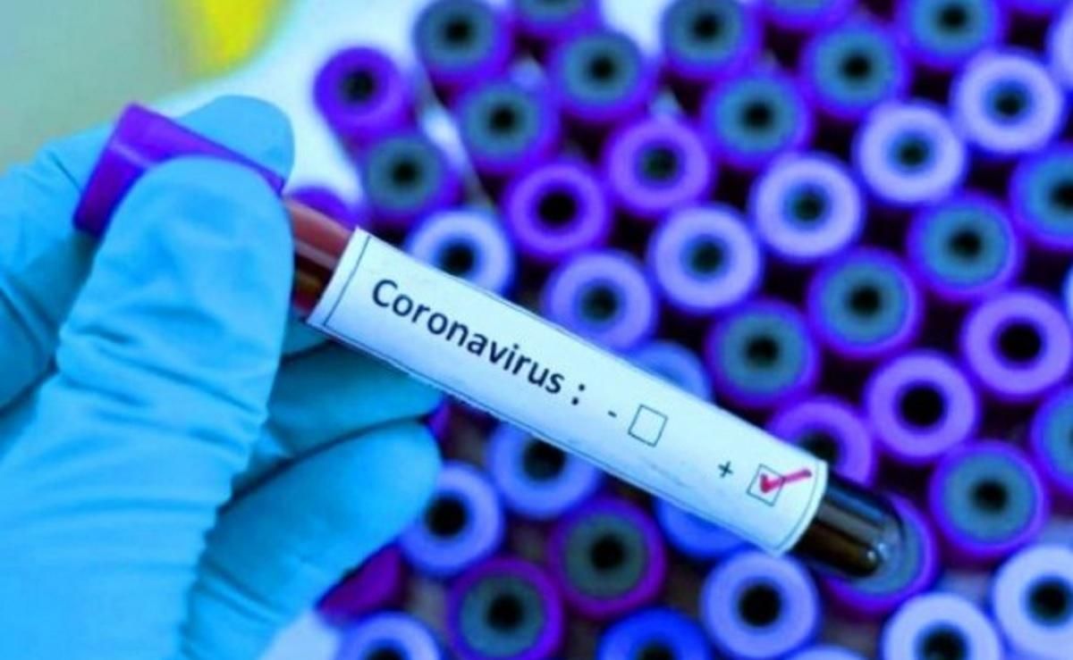 Чого українці бояться більше: коронавірусу чи економічних наслідків карантину – опитування Чого українці бояться більше: коронавірусу чи економічних наслідків карантину – опитування