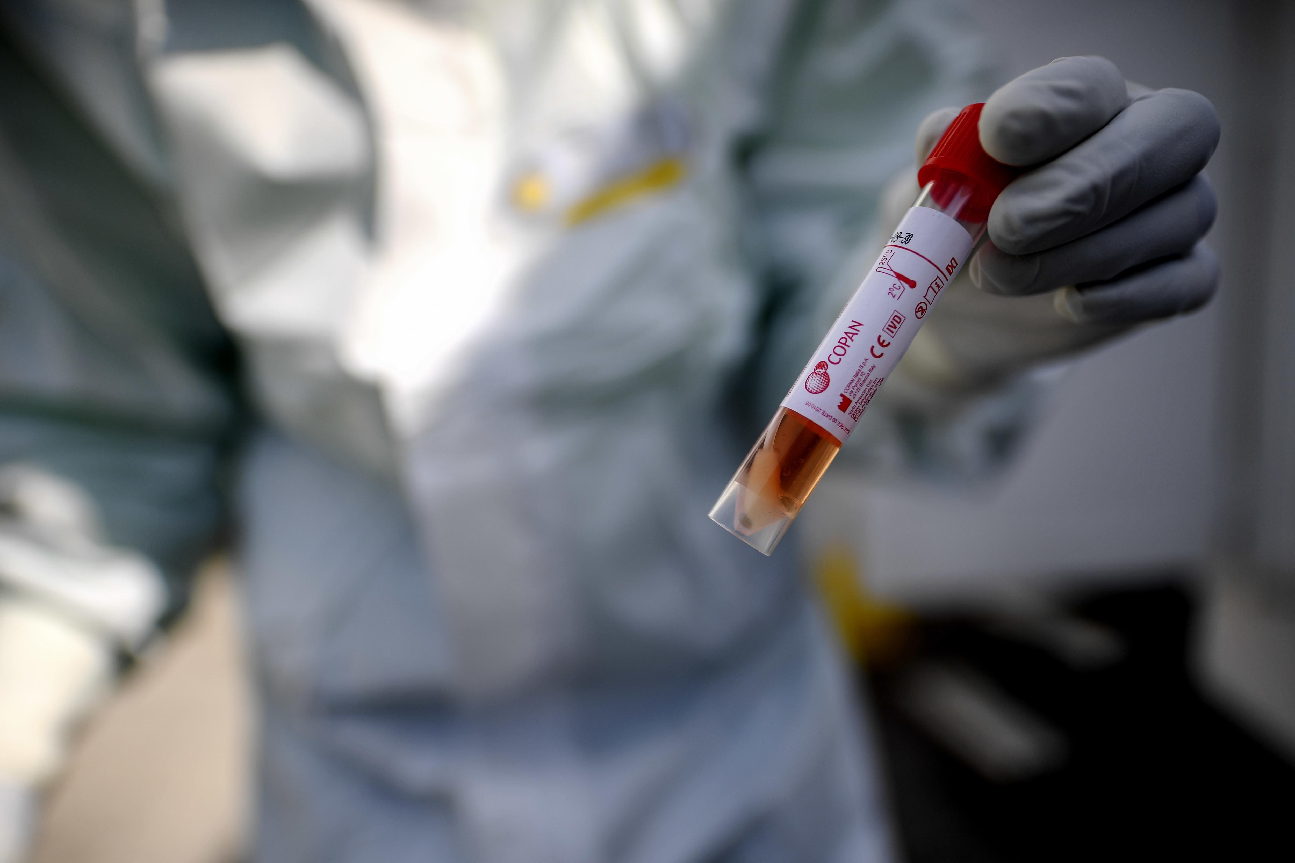 Де нема коронавірусу: перелік країн Де нема коронавірусу: перелік країн