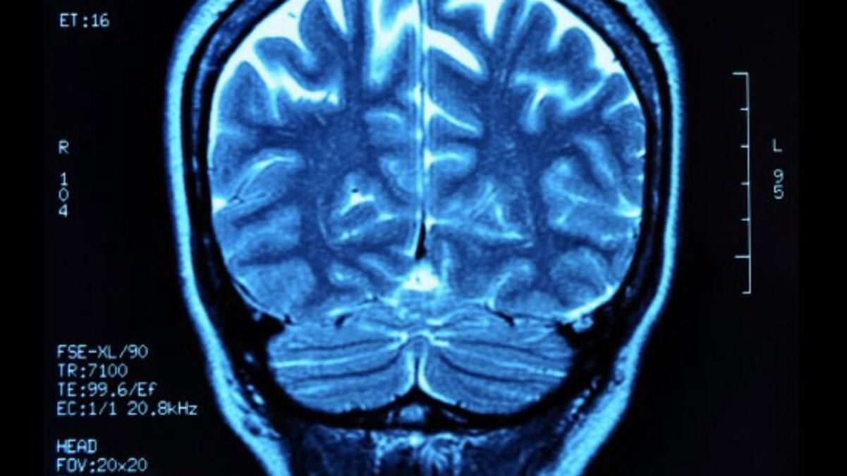Из России поступила томография, – Кислица о скандальном заявлении Кремля в ООН Из России поступила томография, – Кислица о скандальном заявлении Кремля в ООН