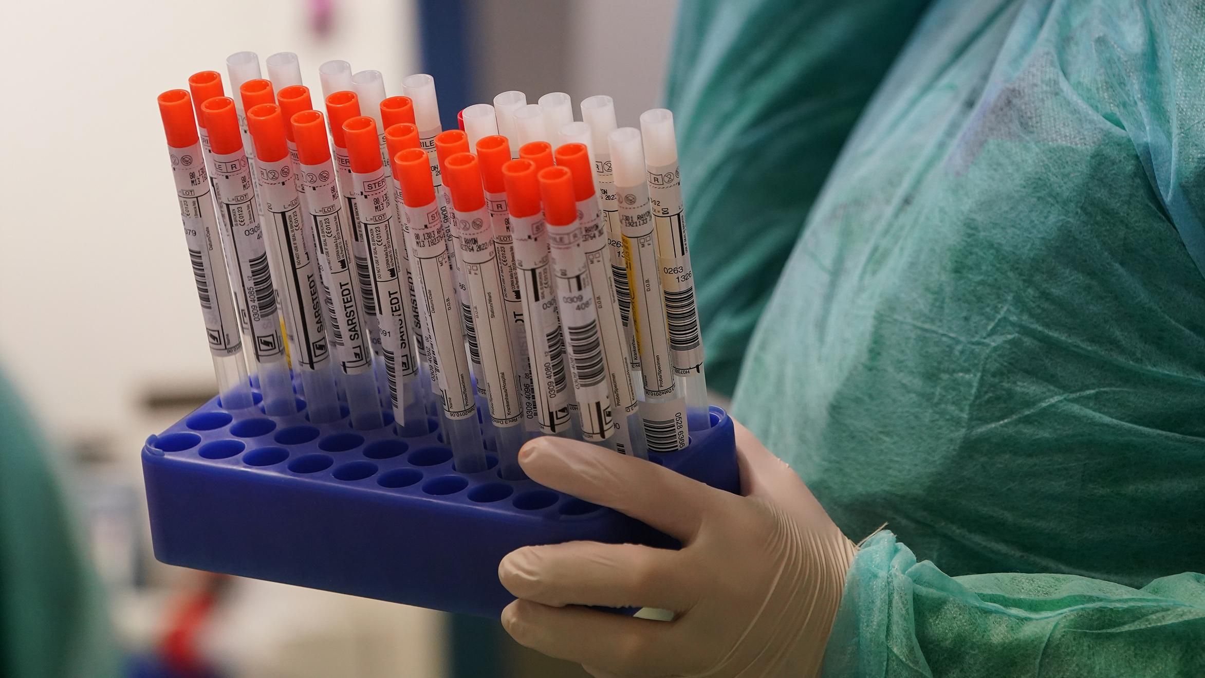 Коронавирус появился в лаборатории в Ухане: у США огромное количество доказательств
