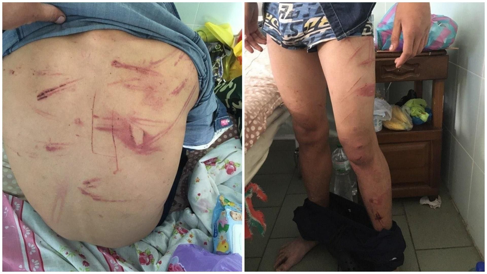 Двое мужчин на Харьковщине насиловали и пытали 17-летнего парня Двое мужчин на Харьковщине насиловали и пытали 17-летнего парня