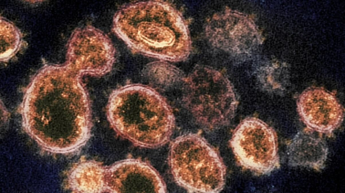 Штучний інтелект передбачає COVID-19 за чотирма симптомами: наскільки ефективний результат Штучний інтелект передбачає COVID-19 за чотирма симптомами: наскільки ефективний результат