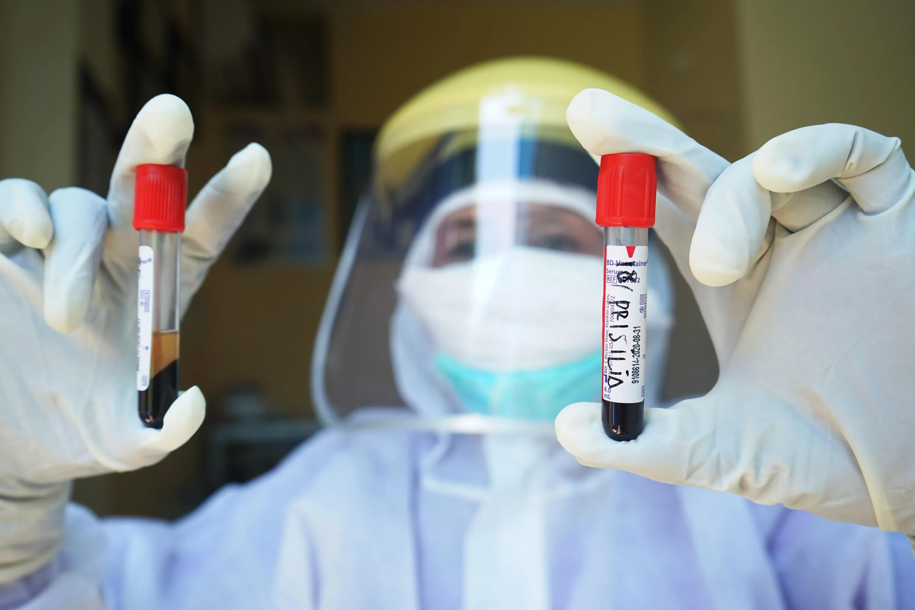 коронавірус