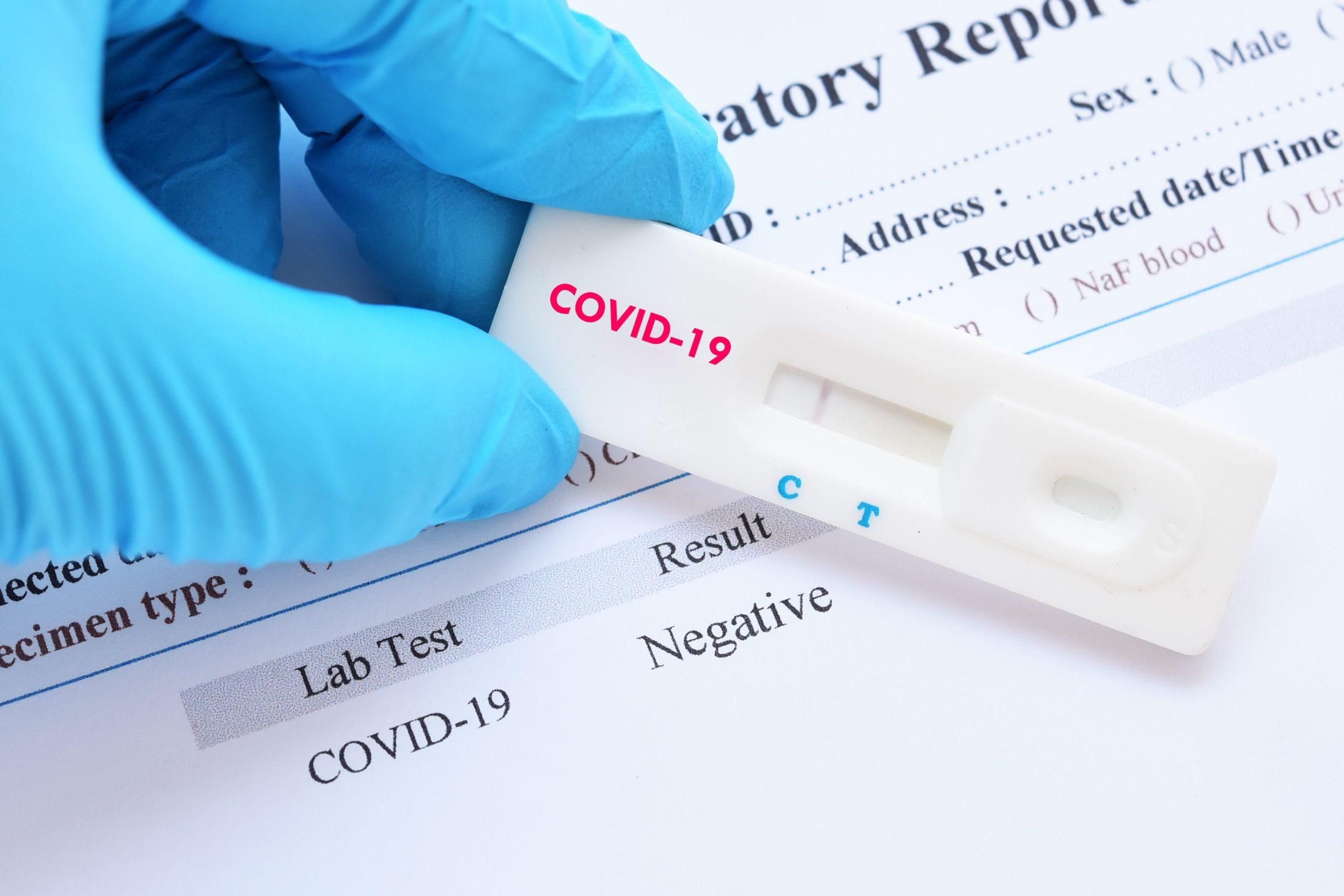 Настоящее количество больных: во Львове запустили экспериментальное тестирование на COVID-19