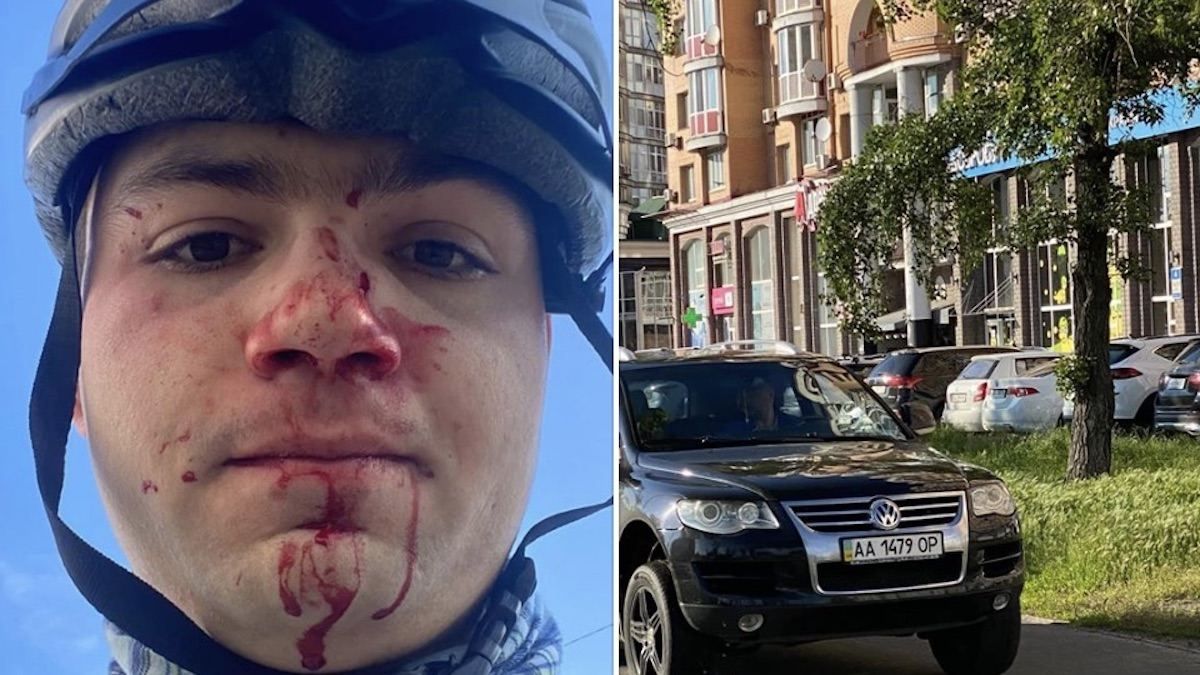 У Києві водій Тойоти побив до крові велосипедиста: фото