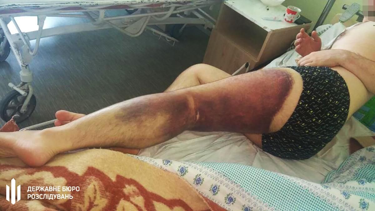 Полицейские и курсант до ужасных синяков избили оператора майнинг-фермы: объявлено подозрения Полицейские и курсант до ужасных синяков избили оператора майнинг-фермы: объявлено подозрения