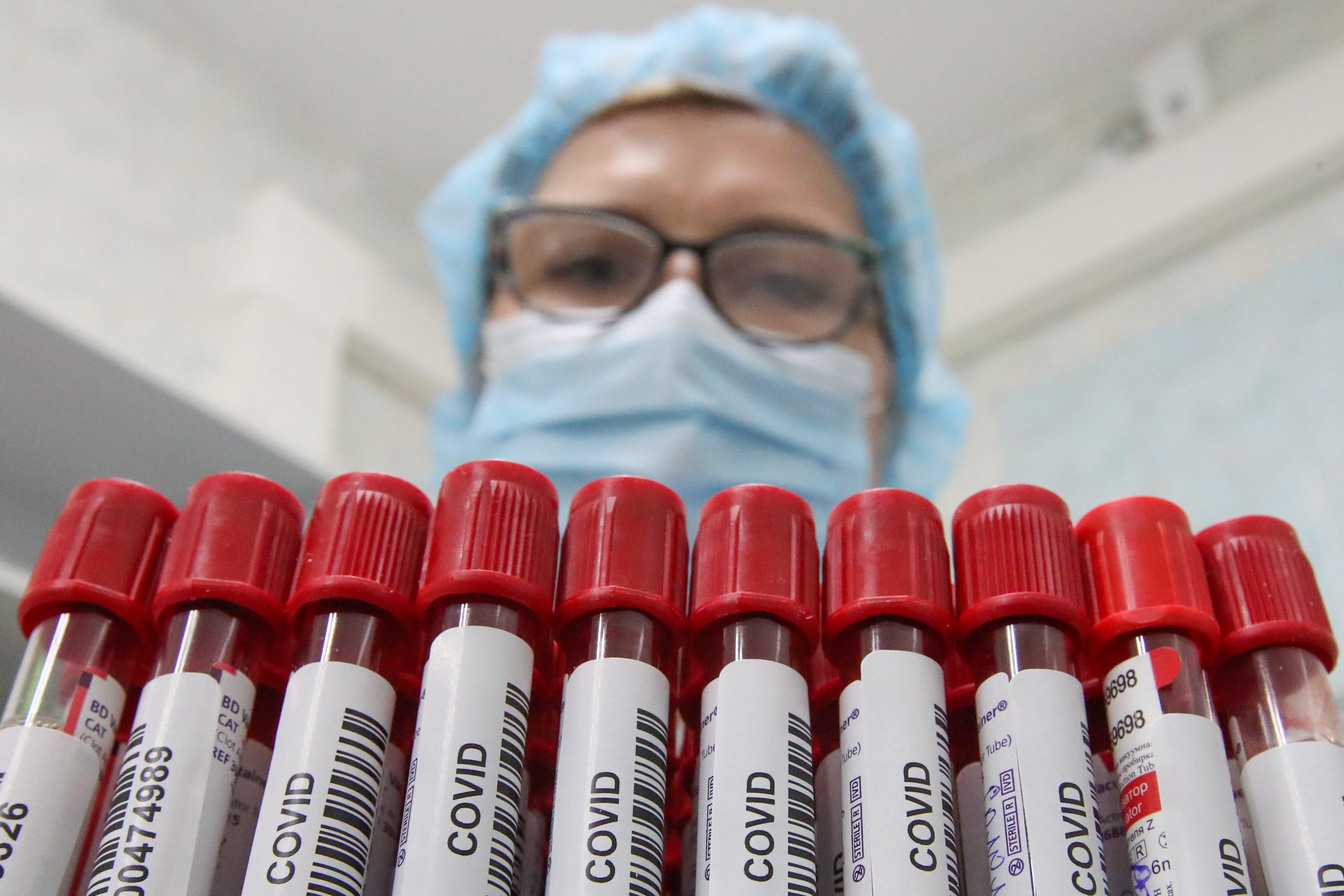 Лікування COVID-19 плазмою крові: застосування в Україні 