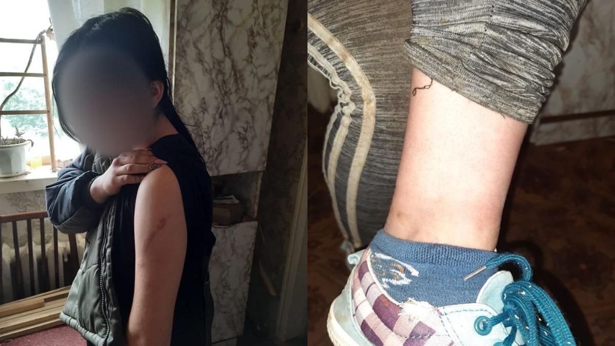 В Луганской области женщина привязывала дочь на цепь В Луганской области женщина привязывала дочь на цепь