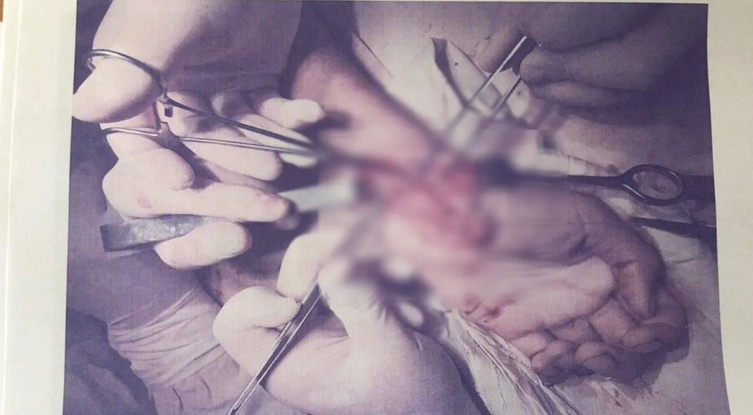 стерненко поранення 18+ стерненко поранення 18+