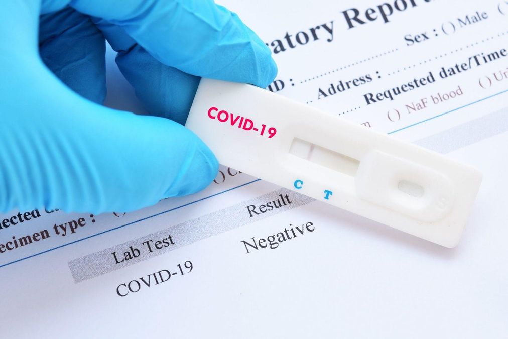 Після приїзду з-за кордону не обов'язково робити тест на COVID-19 Після приїзду з-за кордону не обов'язково робити тест на COVID-19