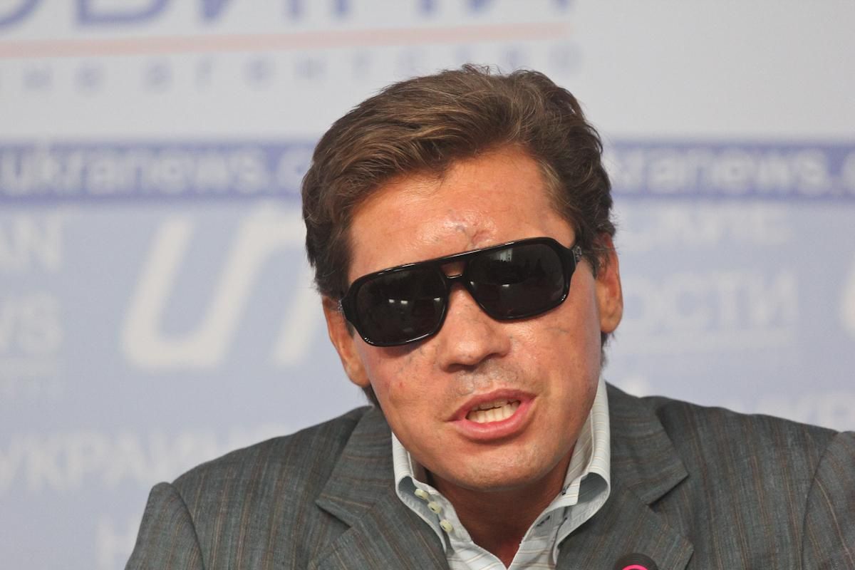 Депутат звинуватив Кличка в передачі грошей фірмі Комарницького Депутат звинуватив Кличка в передачі грошей фірмі Комарницького