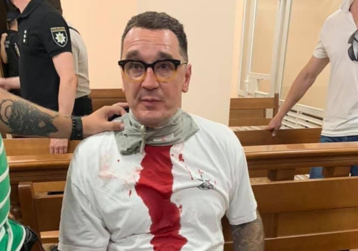 Блогер Домбровский порезал себе горло в суде 31.07.2020: видео