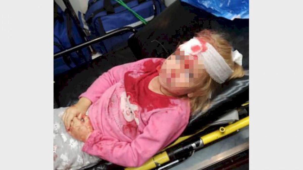 Постраждала дівчинка, яку збив військовий автомобіль у Гродно