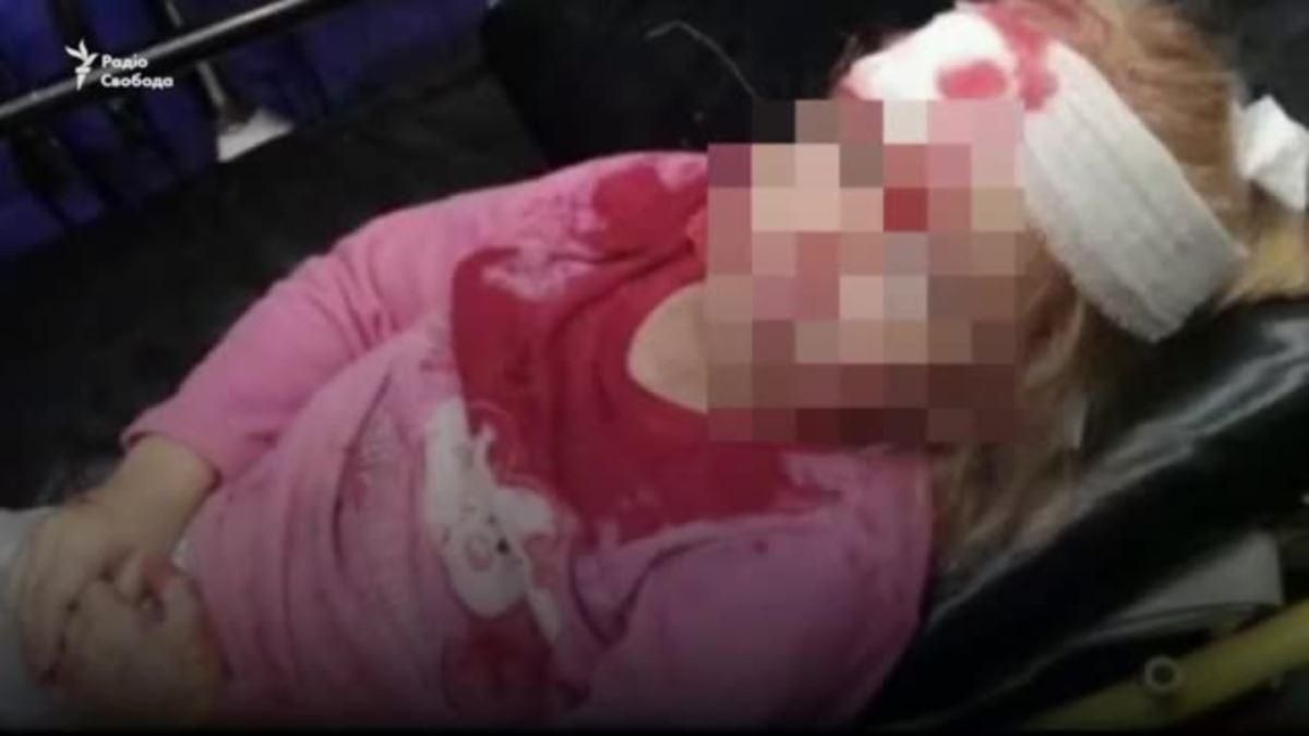 Протести в Білорусі: силовики поранили 5-річну дитину Протести в Білорусі: силовики поранили 5-річну дитину