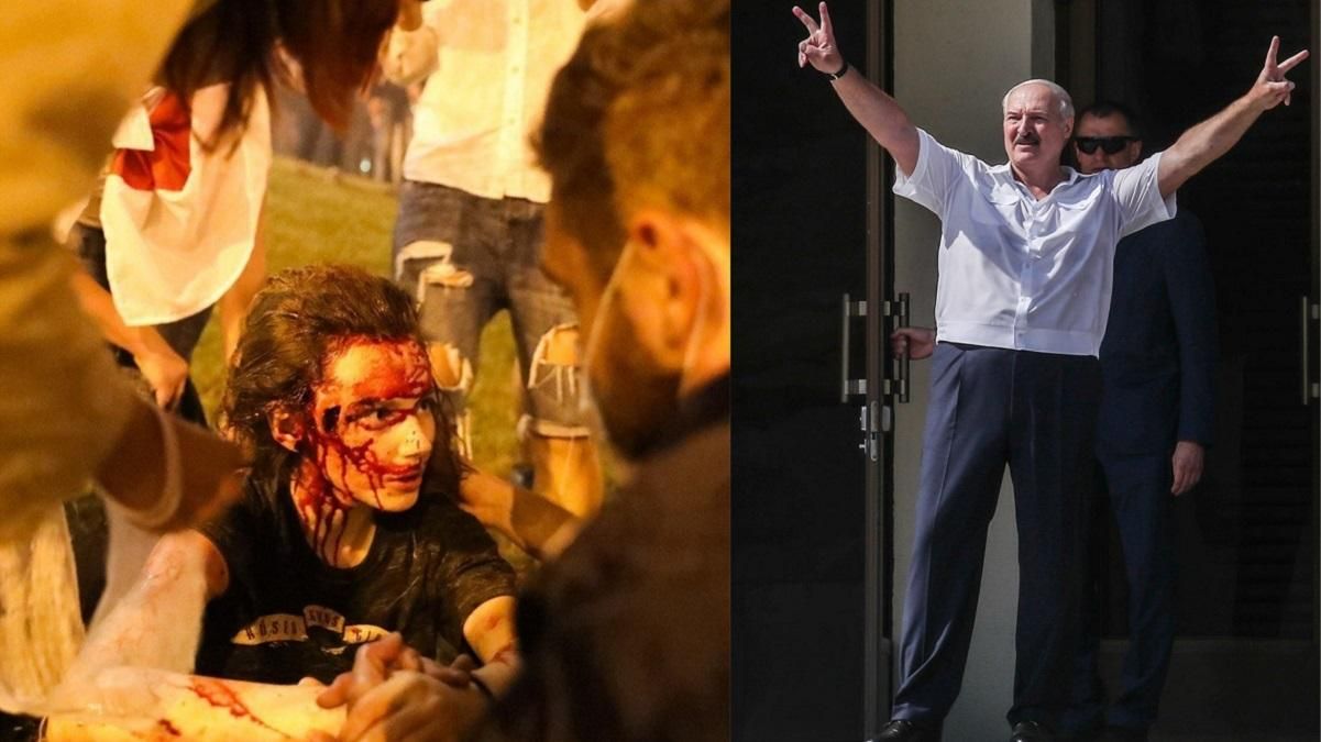 Лукашенко говорит, что фото избитых протестующих – "постановочные кадры" Лукашенко говорит, что фото избитых протестующих – "постановочные кадры"