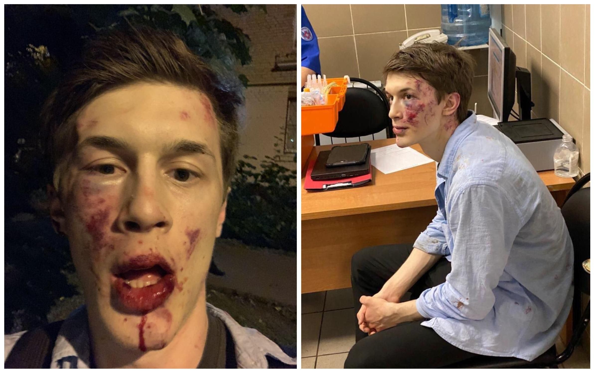 У Росії сильно побили критика політики Кремля Жукова: на активіста тітушки напали біля його дому У Росії сильно побили критика політики Кремля Жукова: на активіста тітушки напали біля його дому