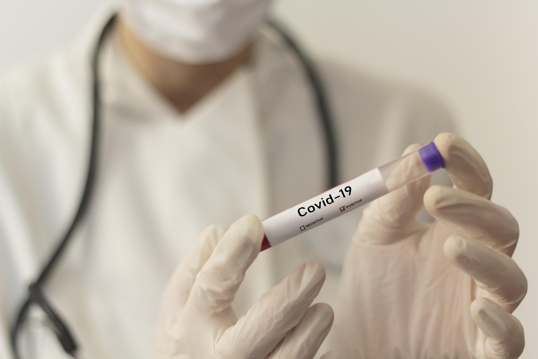 В Одесской области закончились тесты на коронавирус