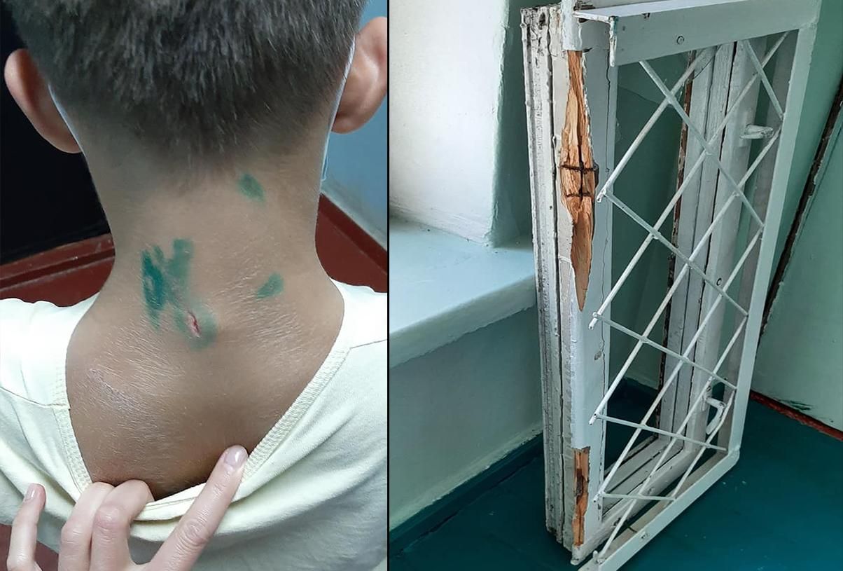 В Сумах во время урока на ученика упала оконная рама: жуткие фото