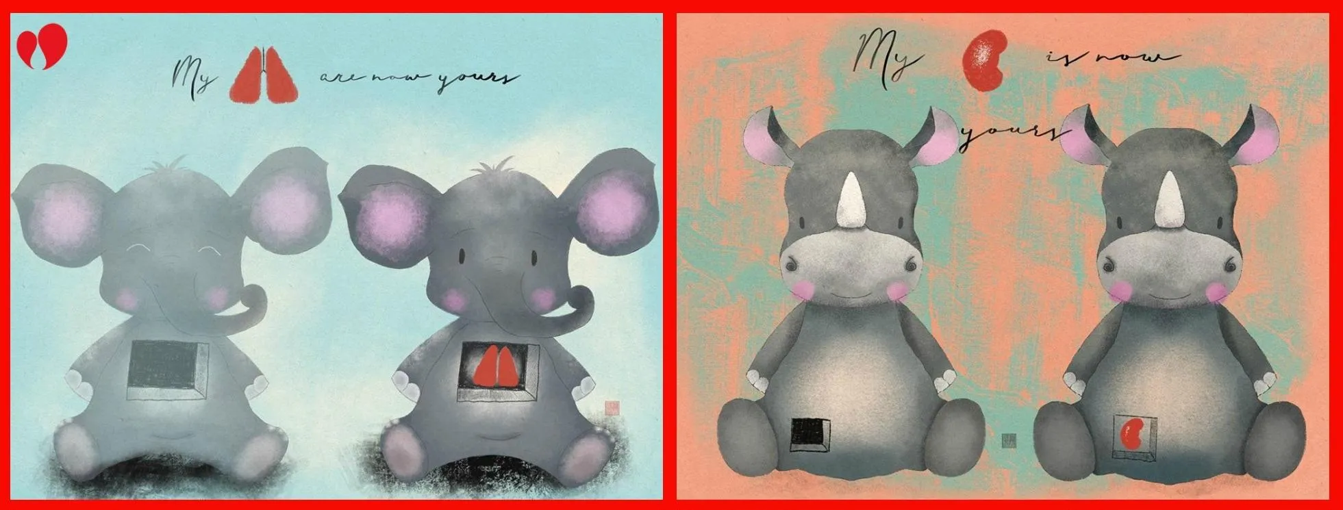 трансплантація трансплантація