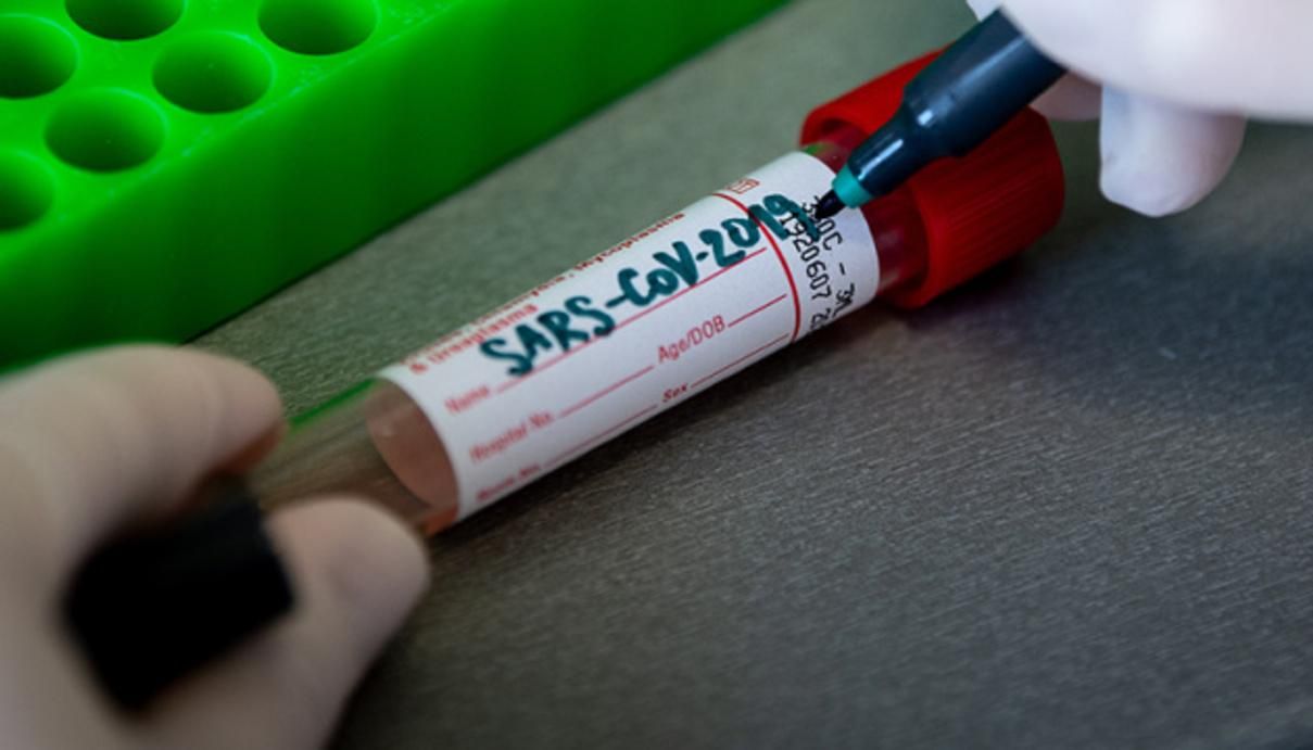 Попраздновали и заболели: Степанов о скачке заболеваемости в Днепре, на очереди – Запорожье Попраздновали и заболели: Степанов о скачке заболеваемости в Днепре, на очереди – Запорожье