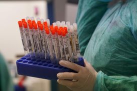 Правительство заставило Минздрав увеличить количество тестирований на коронавирус